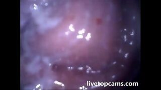 Inside of vagina video