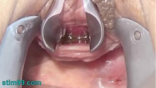 Kristybennet urethra