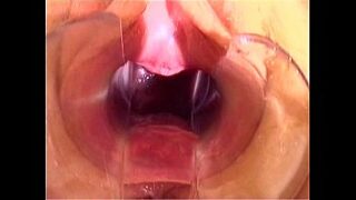 Vaginal Speculum